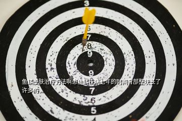 魚鱗皮膚治療方法啊患魚鱗疾病七年的時(shí)間背部整塊長了許多的